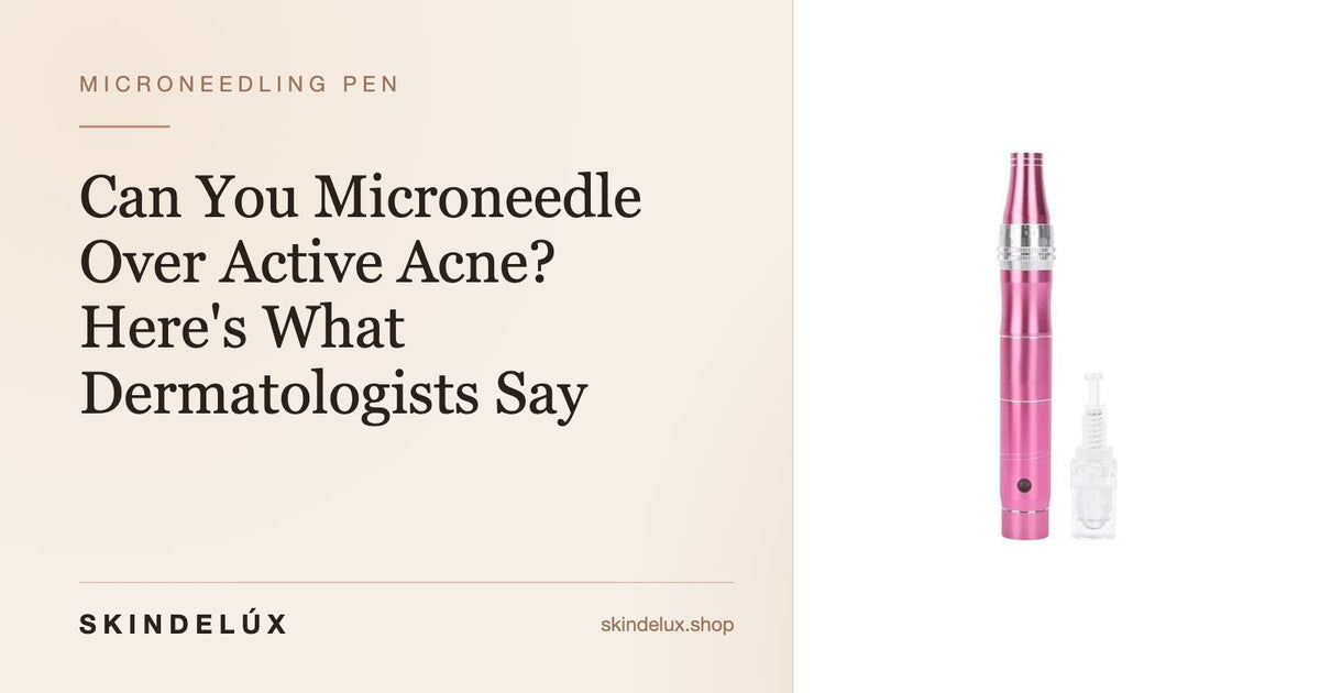 Can You Microneedle Over Active Acne? Here's What Dermatologists Say - Skin Delux