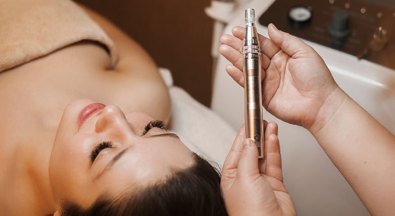 Frequently asked questions about microneedling - Skin Delux