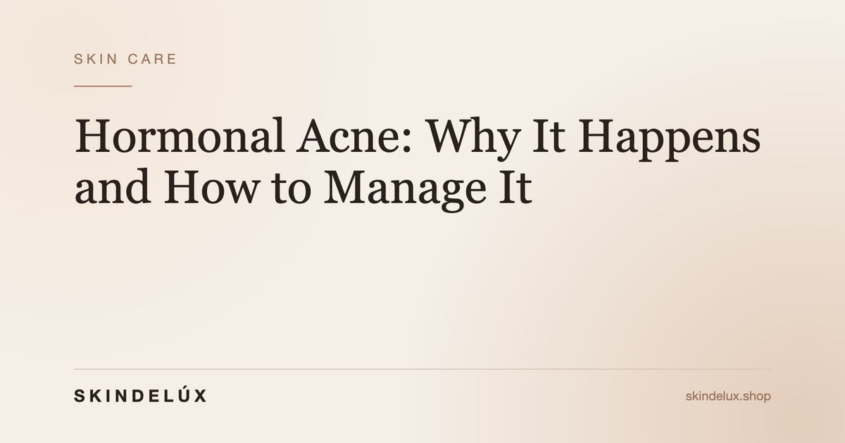Hormonal Acne: Why It Happens and How to Manage It - Skin Delux