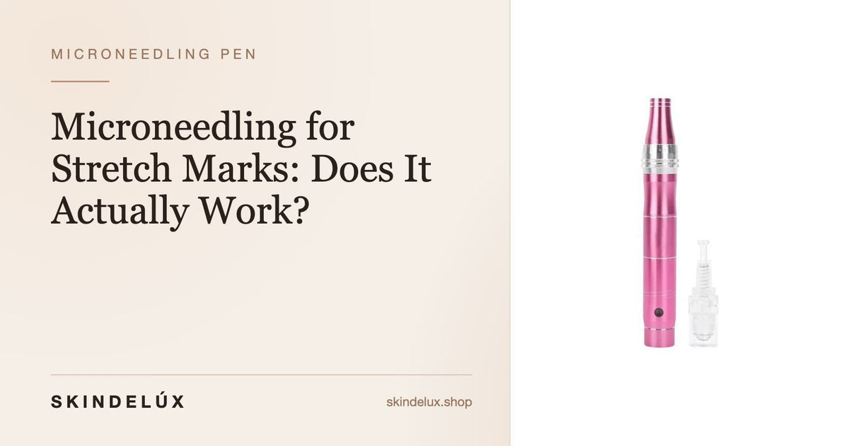 Microneedling for Stretch Marks: Does It Actually Work? - Skin Delux