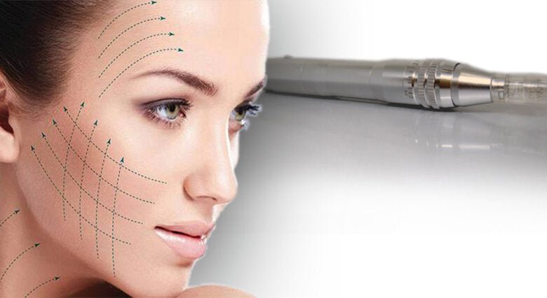 Microneedling Instruction Guide (MUST HAVE) - Skin Delux