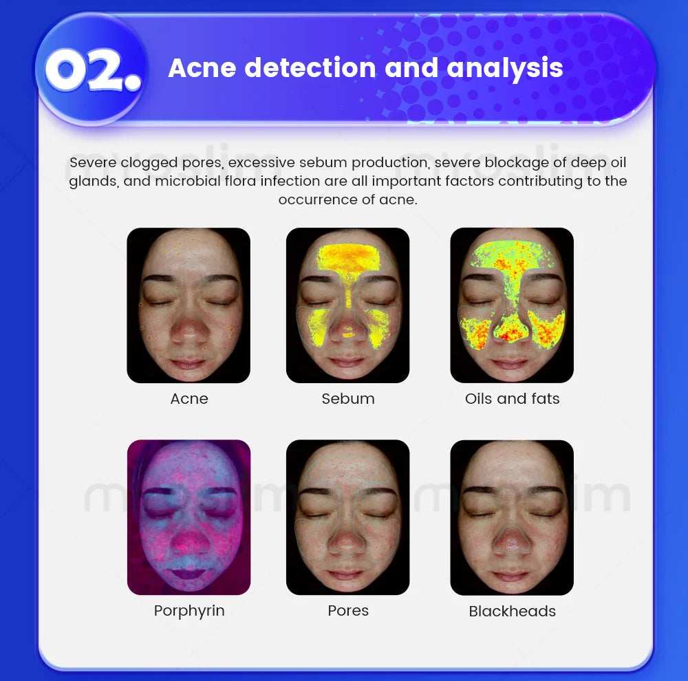 SKINDELÚX 3D AI Hair &amp; Scalp Analyzer - Multi-Spectrum Professional Diagnostic Scanner
