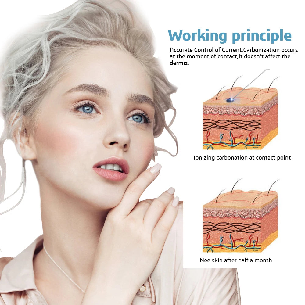 4TH Mole Remover Plasma Pen Fibroblasts PAA Ozone Freckle Tag Wart Removal with Replace Needles Beauty Care Tools