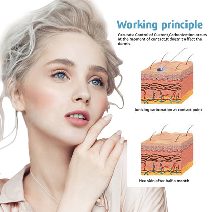 4TH Mole Remover Plasma Pen Fibroblasts PAA Ozone Freckle Tag Wart Removal with Replace Needles Beauty Care Tools