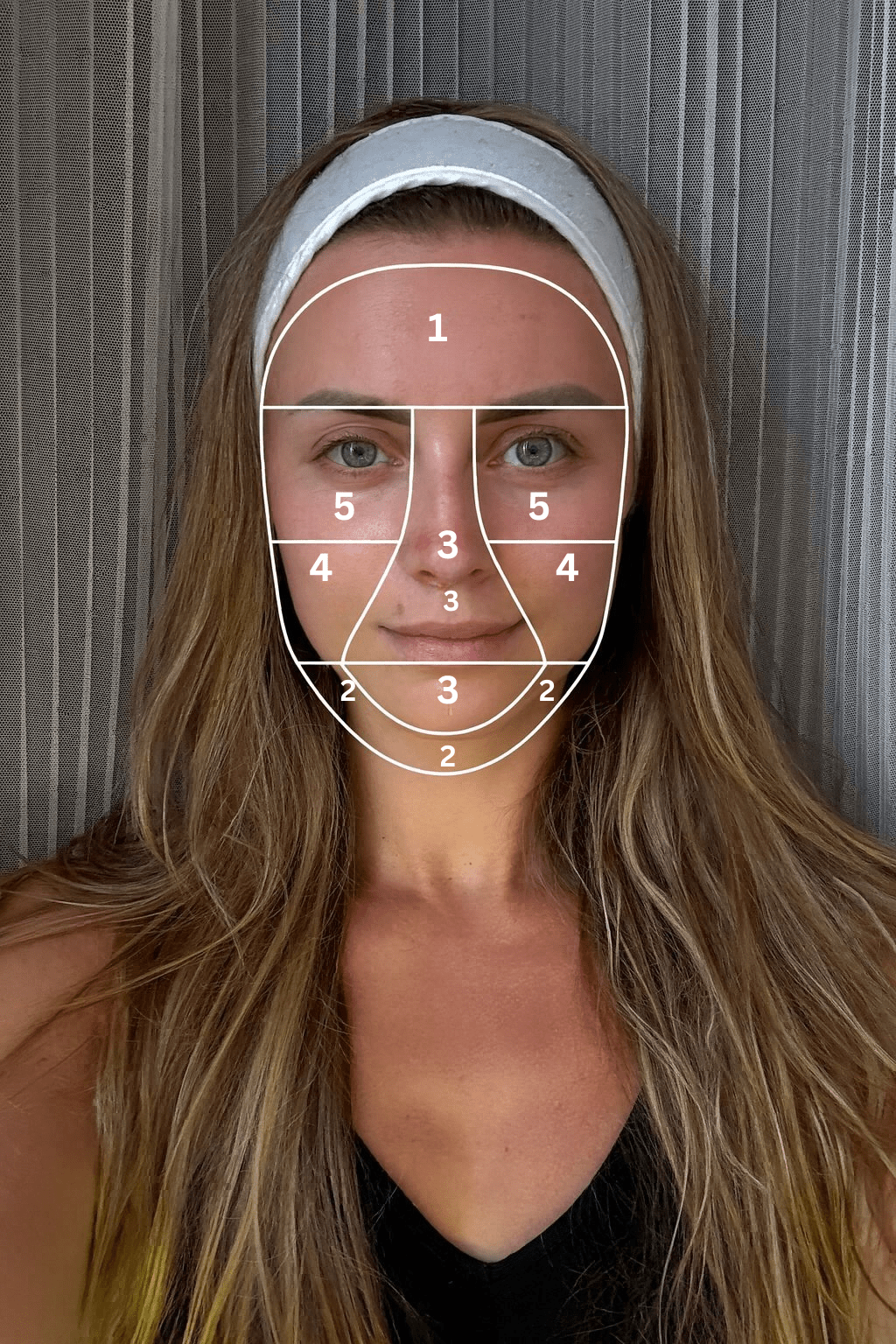 Microneedling: Safe &amp; Effective Course by SKINDELUX - Skin Delux