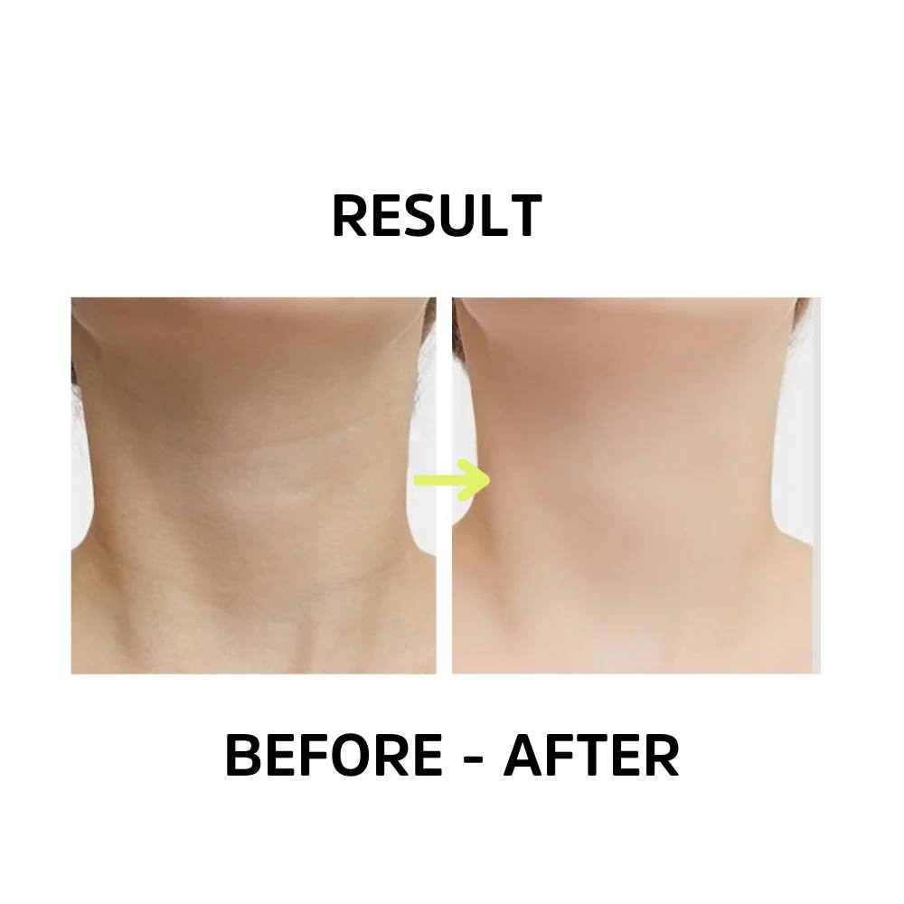 3-in-1 Neck Sculpting Device by SKINDELUX